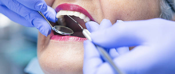 Best Teeth Whitening  in Woodville, FL