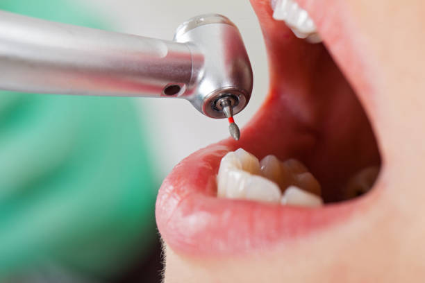 Best Broken Tooth Emergency  in Woodville, FL